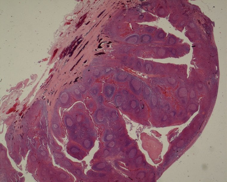 Raman spectroscopy measures corona infected cells